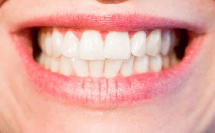 Obecna technologia używana w salonach stomatologii estetycznej może sprawić, że odzyskamy śliczny uśmiech.